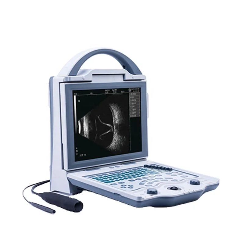 

Popular 10HMZ Probe AB Scan Ophthalmic Uultrasound with Clear Images