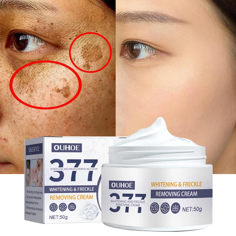 

Effective Whitening Freckles Cream Remove Melasma Dark Spots Lightening Melanin Brighten Moisturizing Beauty Face Skin Care 50g