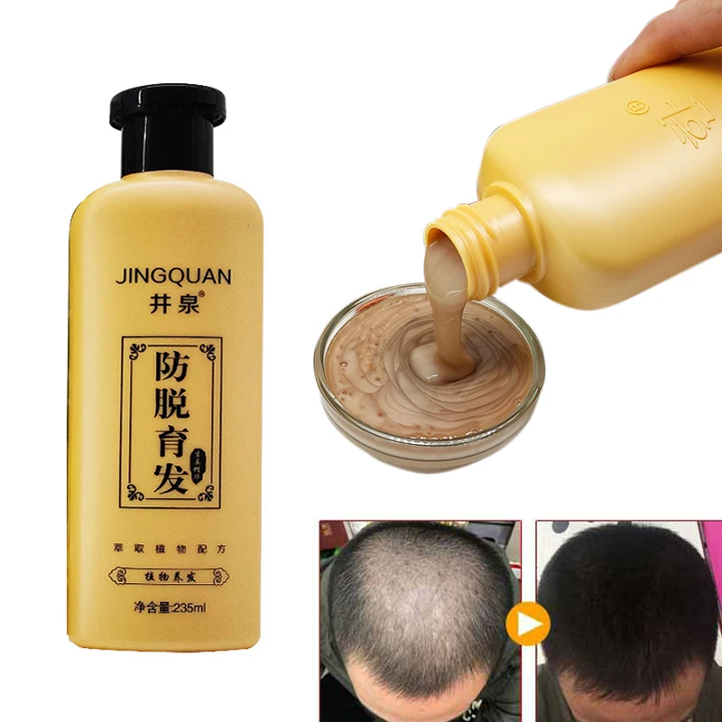 235ml original effective Anti hair loss Shampoo hair growth Plant anti hair care shampoo for dandruff itching free shipping