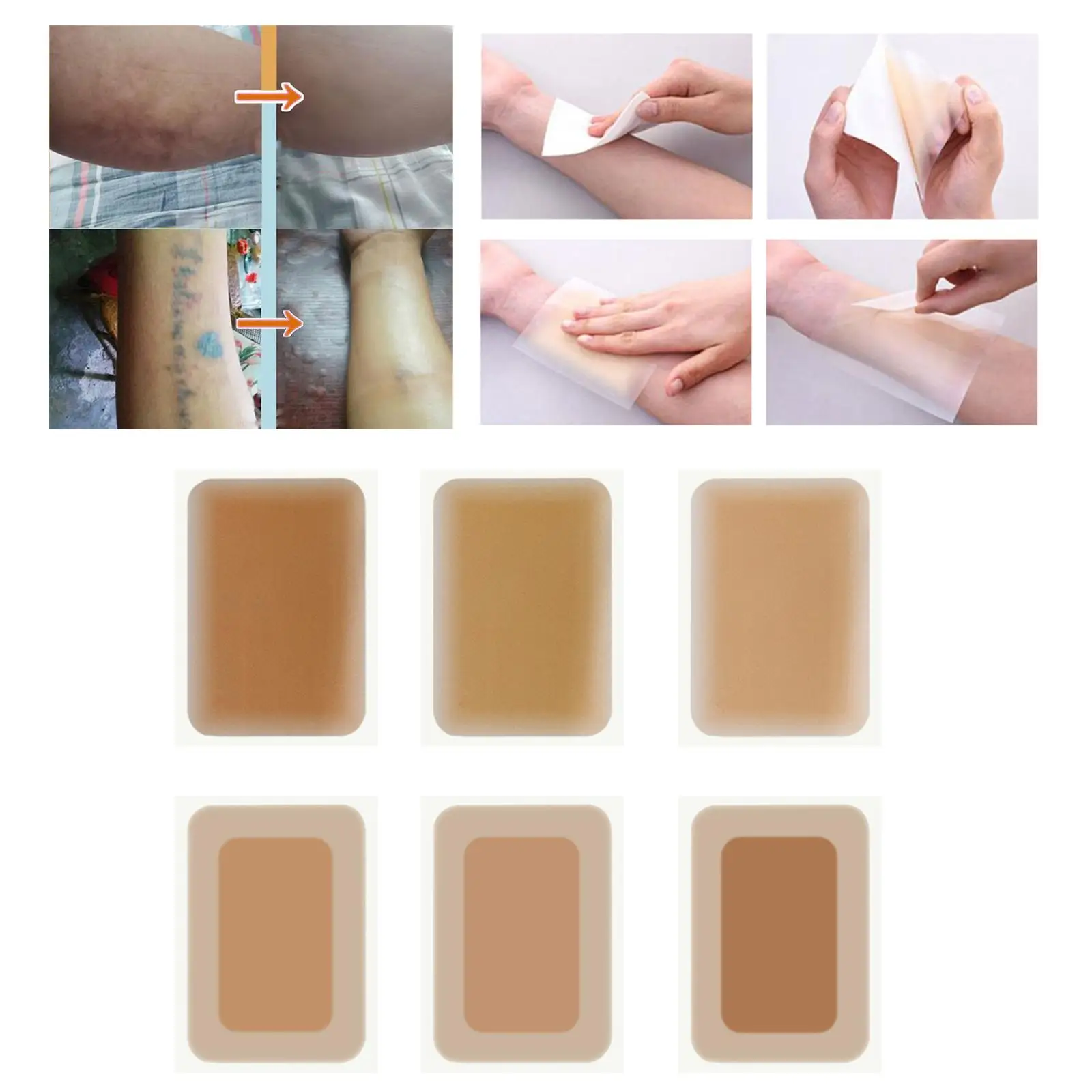 

up Sticker Portable Scars Removal Sheet Scar Flaw Concealing Tape for Women Men Birthmark Surgeries Burns Scars