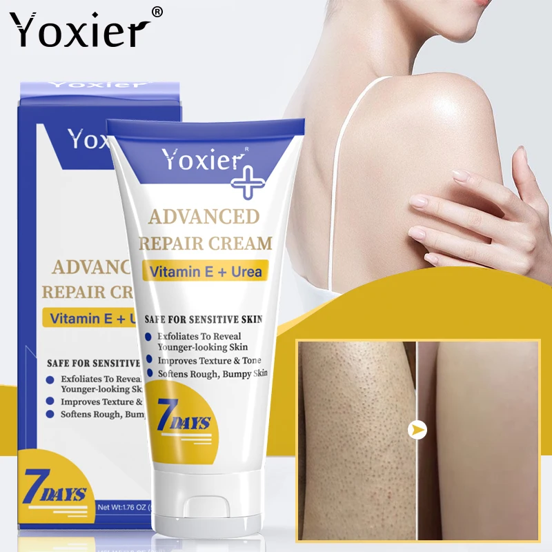 Moisturizing Cream Improve Keratosis Pilaris Vitamin E Dry Skin Repair Cream Smooth Skin Remove Thick Pores Brighten 50g