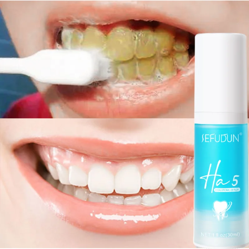 

Отбеливающая зубная паста V34 для отбеливания зубов, яркие белые чистящие пятна, удаление цветного корректора, отбеливание, уход за полостью рта