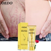 maternity stretch marks removal cream anti aging anti winkles firming skin care whitening moisturizing repair korean cosmetics