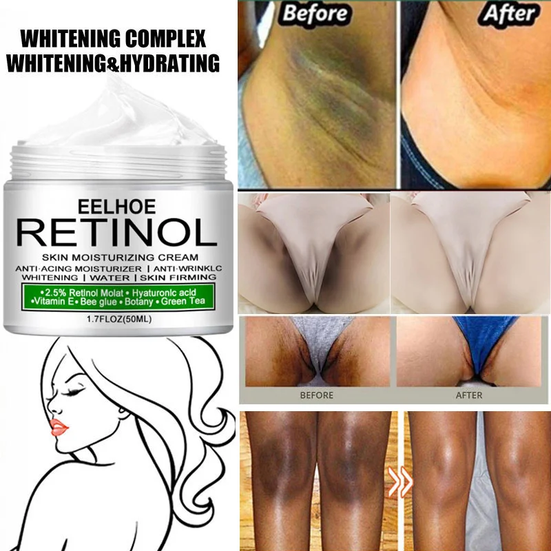 

Retinol Body Whitening Cream Underarm Knee Buttocks Private Bleach Remove Melanin Pigmentation Improve Dull Brighten Skin Care