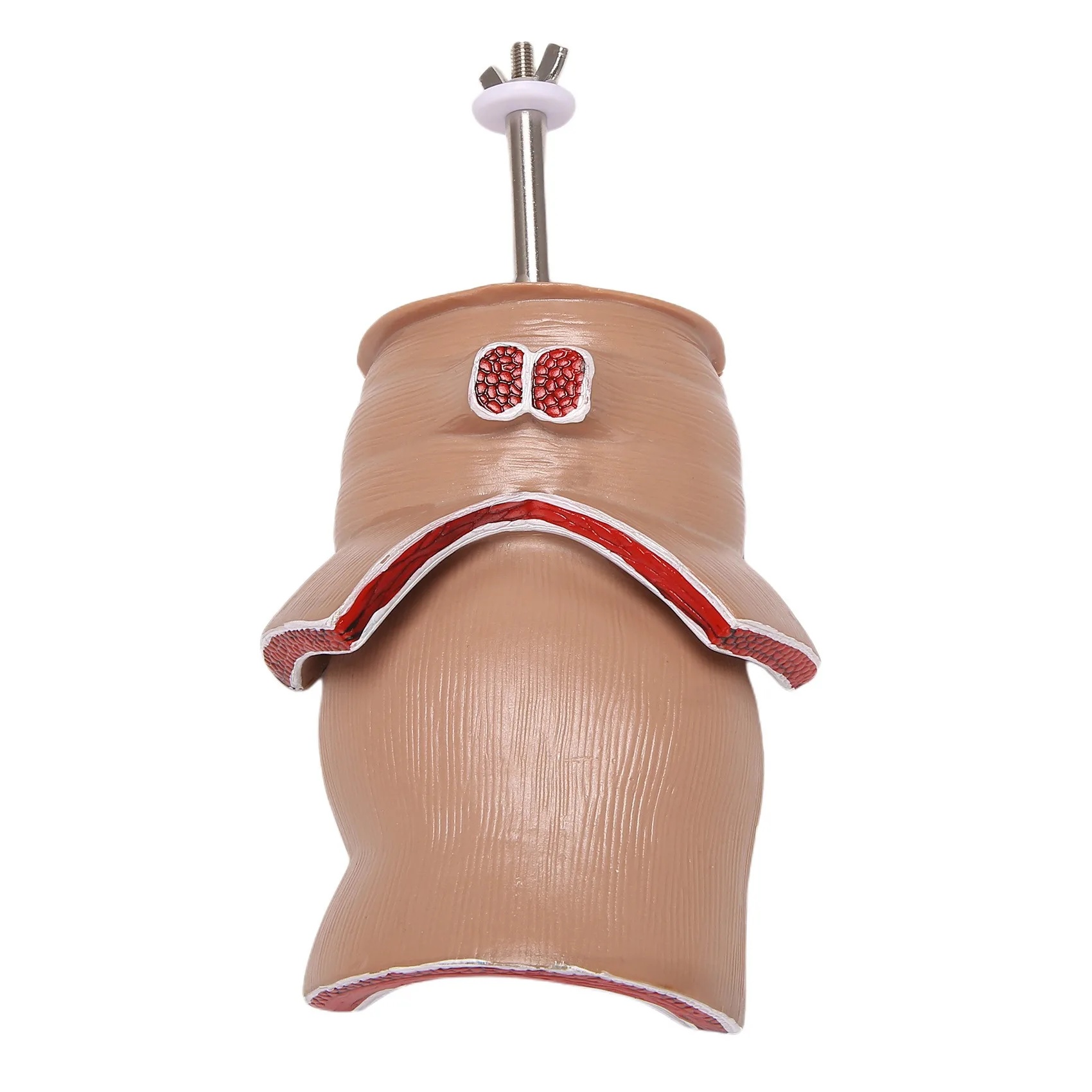 

Анатомическая модель человеческого ректального геморроида, имитация геморроидальной фистулы, физическая трещина, обучающая модель