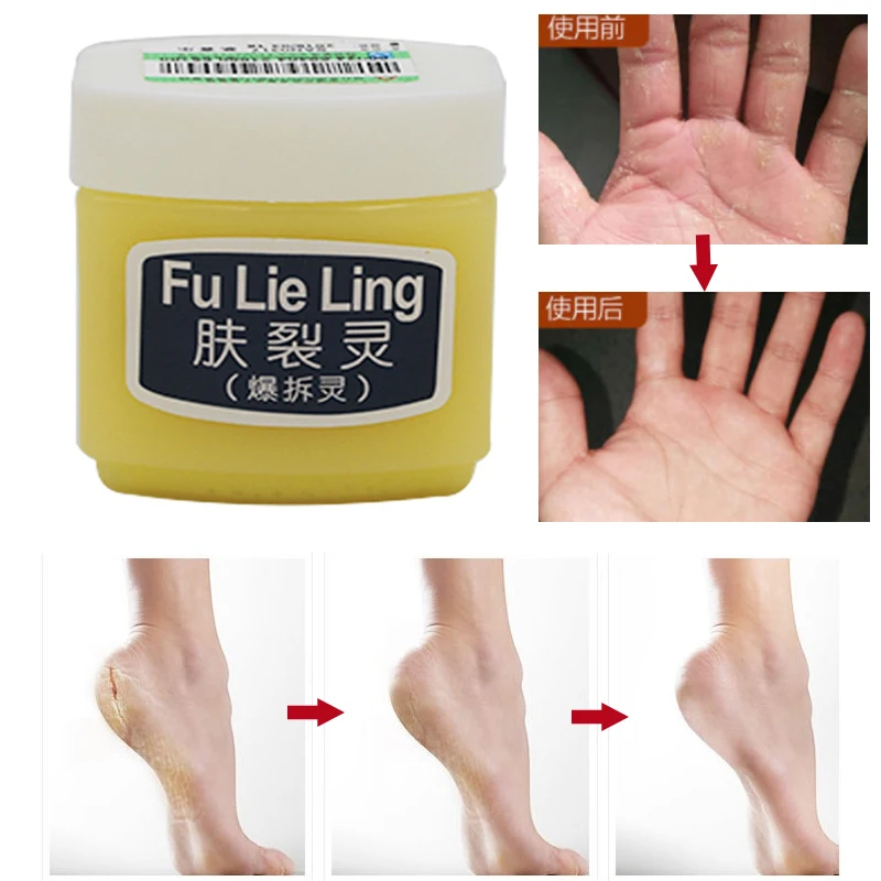Anti Drying Cracked Repair Cream Removal Dead Skin Hand Feet