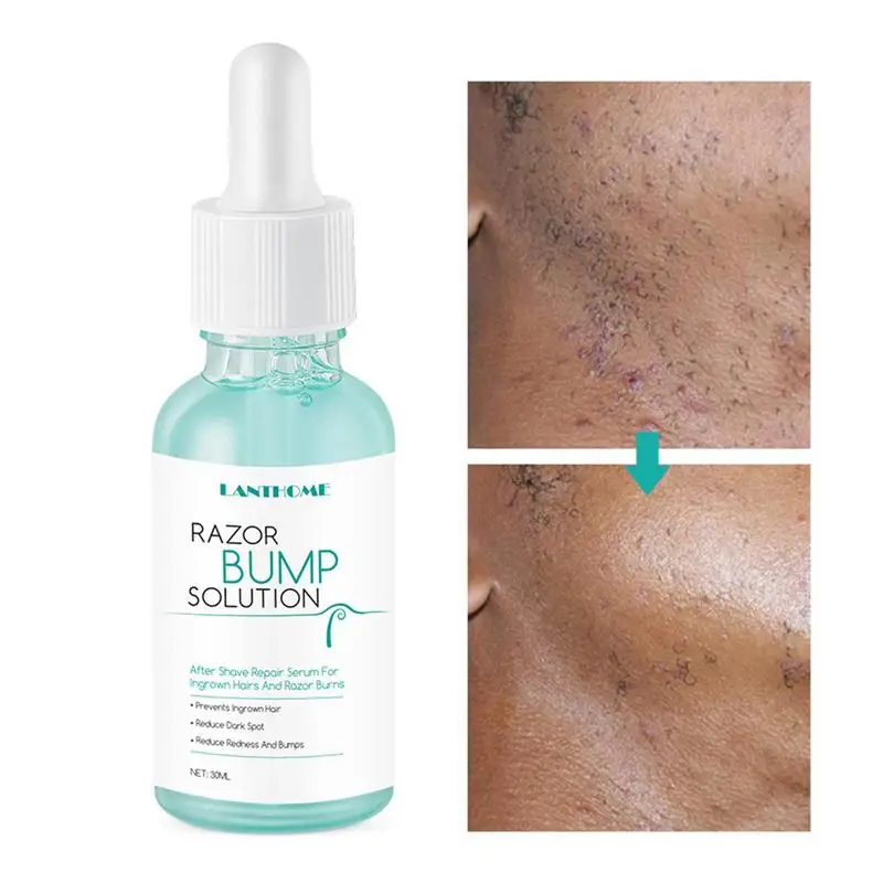 

30ml Razor Bump Stopper Prevent Ingrown Hair Mild Serum Reduce Redness Smooth&Repair Skin After Shaving&Waxing Skin