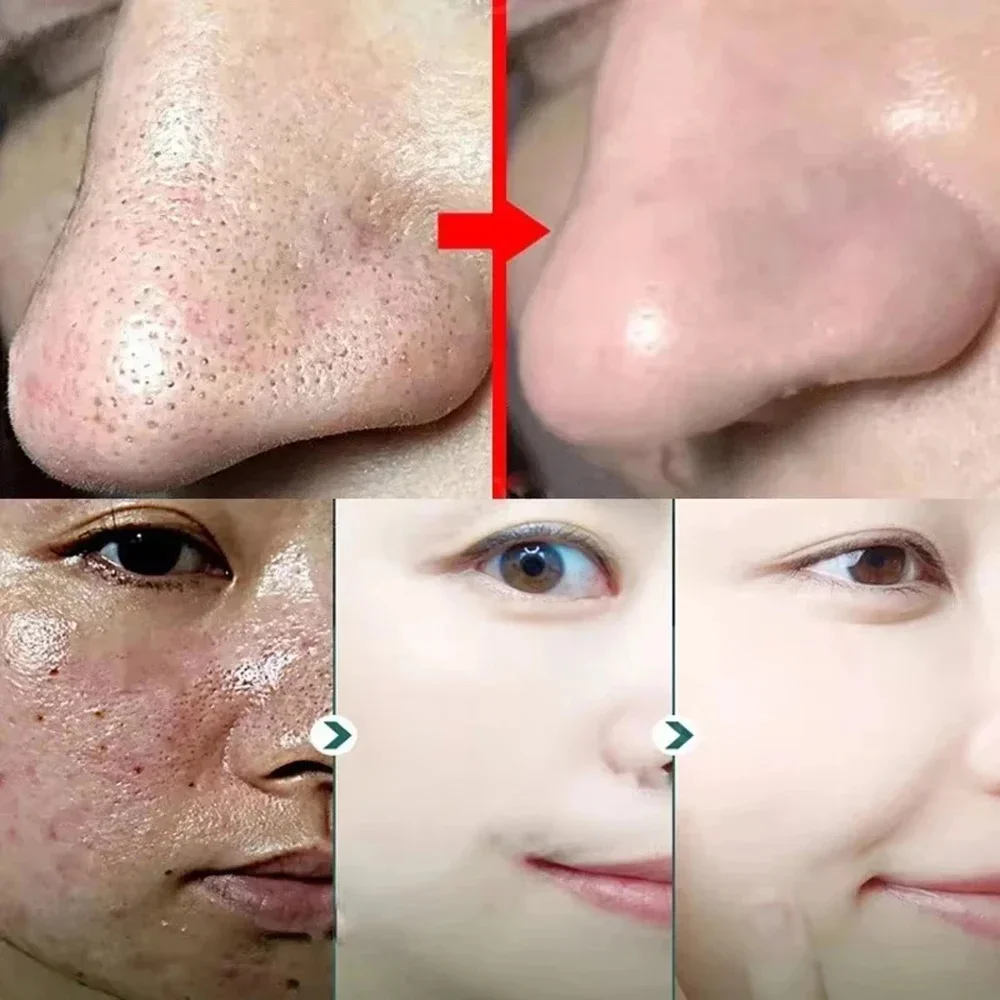 Оригинальная твердая маска для удаления черных точек с зеленым чаем лечение