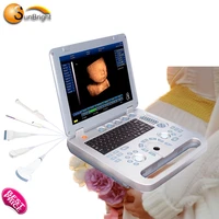 3d portable ultrasound machine digital imaging laptop ultrasound scanner
