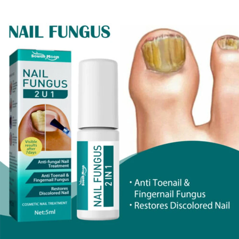 

100% Original Nail Fungus Treatment 7DAYS Repair Feet Care Essence Anti Infection Onychomycosis Foot Toe Nail Fungal Removal Gel