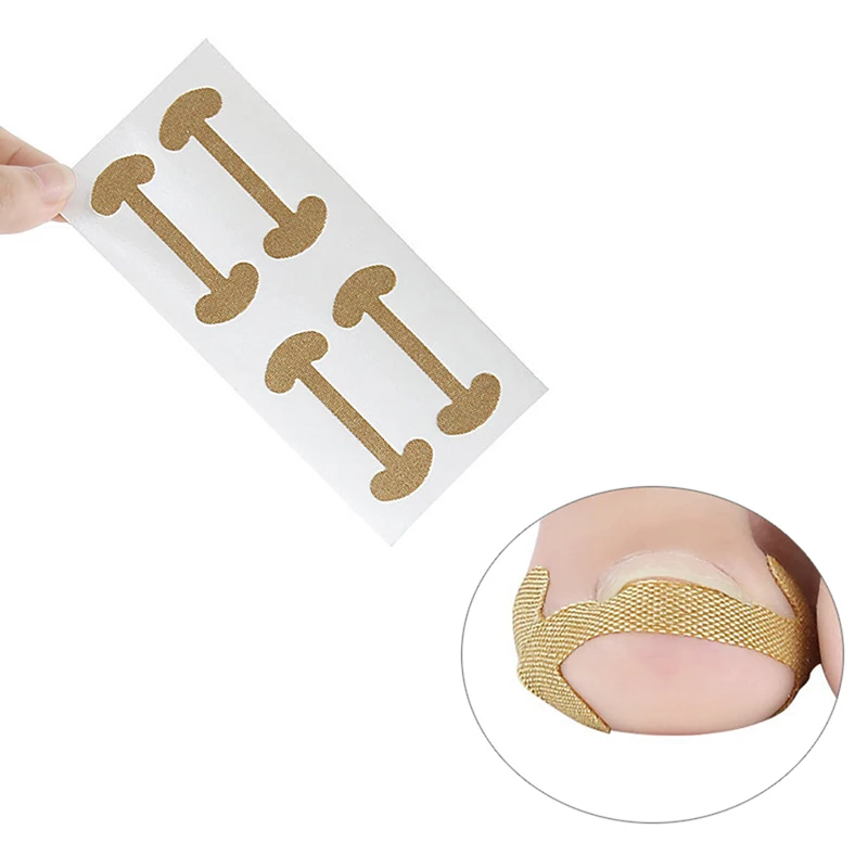 

3Set Ingrown Toenail Corrector Stickers Paronychia Treatment Pedicure Nail Care