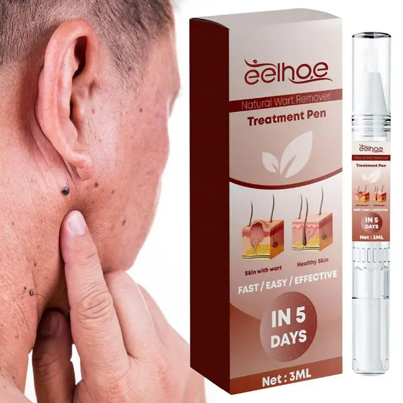 

Средство для удаления родинок эффективное и безрубчивое, средство для ухода за кожей шеи, лица, подмышек и ног