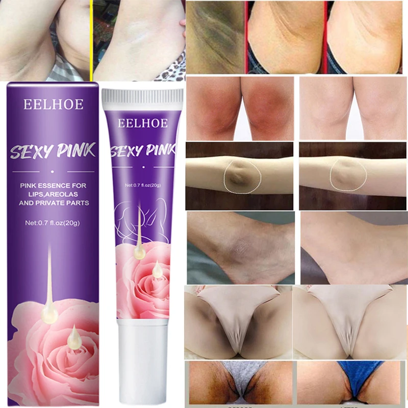 

Body Whitening Cream Private Parts Underarm Bleaching Serum Brighten Improve Butt Knee Inner Thigh Intimate Dark Remove Melanin