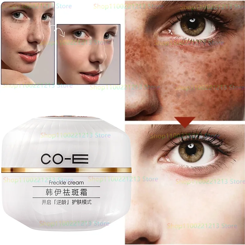 

Freckle Cream Lightening Spots, Acne Marks, Brightening Skin, Anti-dark Cream, Whitening and Lightening Cream