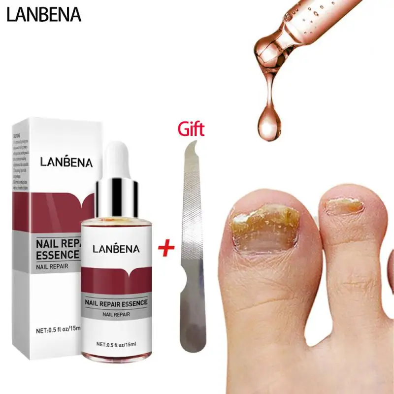 

LANBENA Nail Repair Essence Serum Anti Fungal Nail Treatment Remove Onychomycosis Nourishing Brighten Hand Foot Toes Nail Care