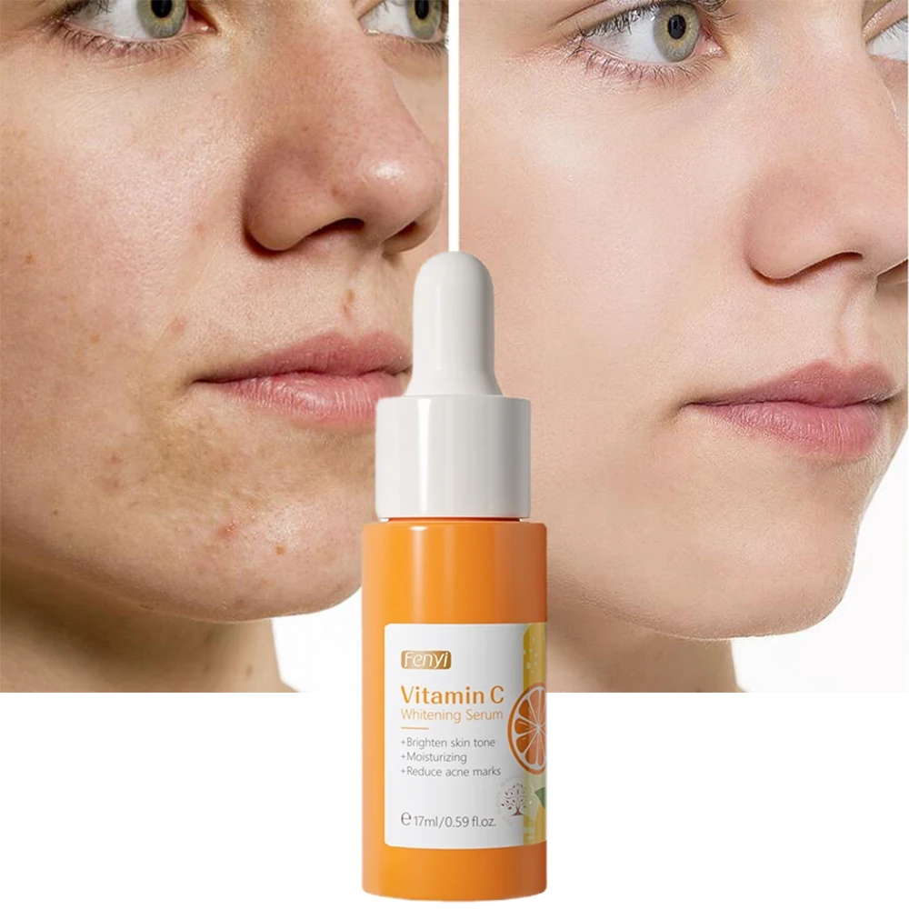 

Vitamin C Essence 17ml Moisturizing Vc Brighten Tighten Control Oil Repair Soothe Soften Improve Skin Tone Skin Is Elastic