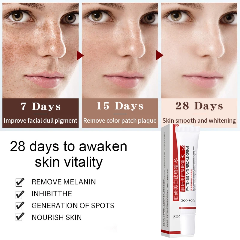 Ниацинамидный отбеливающий крем для лица темные пятна средство удаления