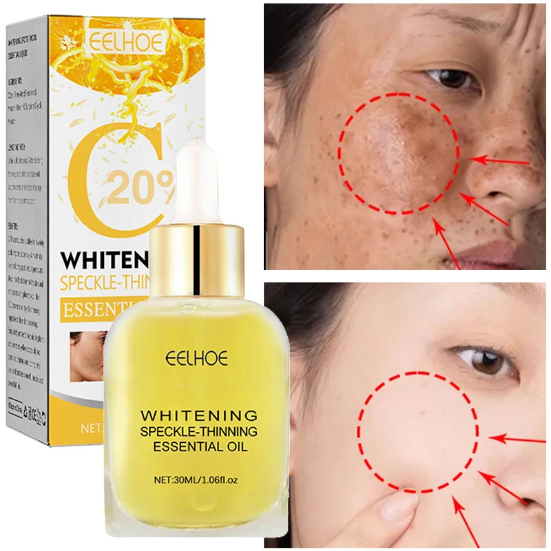 

Effective Whitening Freckle Essence Products Vitamin C Remove Dark Spots Face Serum Fade Pigmentation Melasma Brighten Skin Care