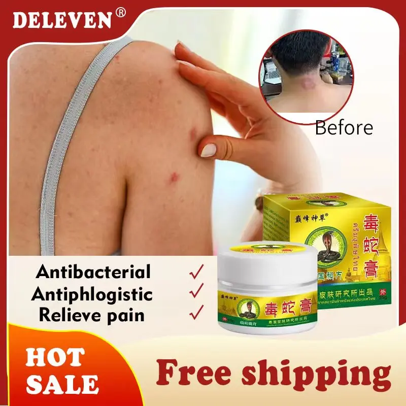 

DELEVENHerbal Cream Dermatitis Eczema Psoriasis Treatment Moisturizing Antipruritic Ointment Effectively Relieve Itching Lumps