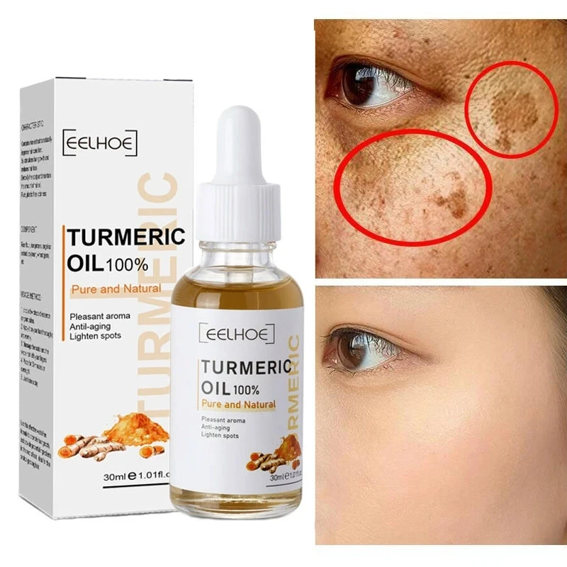 

Turmeric Freckle Whitening Serum Curcumin Oil Brighten Fade Dark Spot Removal Pigment Melanin Correcting Beauty Face Skin Care
