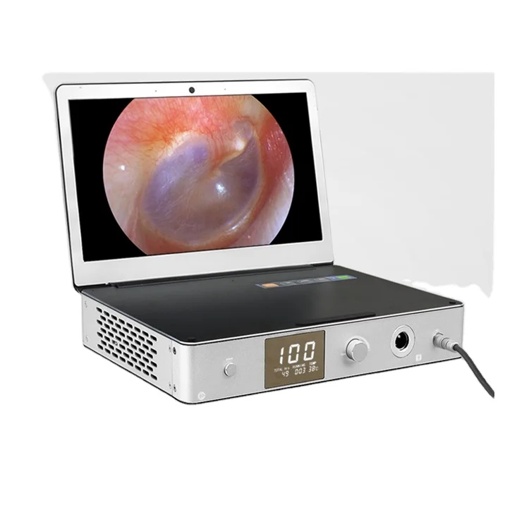 

Medical 1080P/30FPS HD Endoscopy Camera 30W LED Light Source 11.6"IPS USB3.0