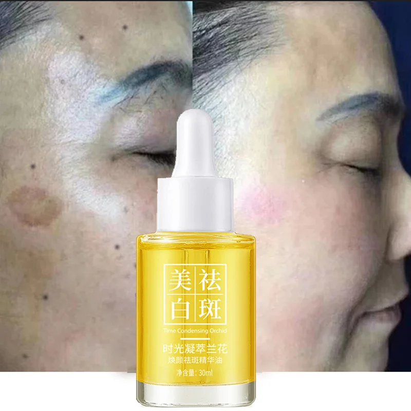 2pcs Whitening and Freckle Removal Time Condensation Orchid Essence Oil Spot Dissolving Oil Moisturiz Moisturizing and Hydrating