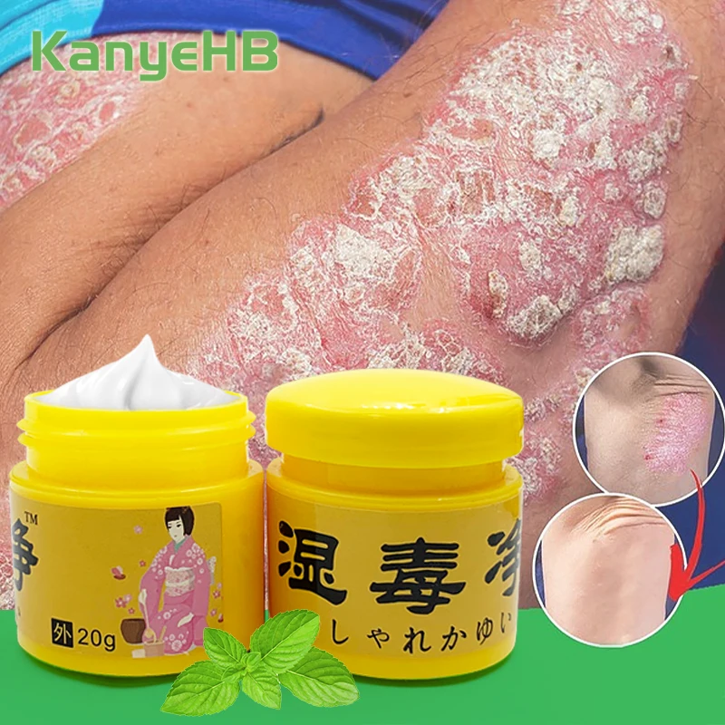 Крем для лечения экземы при псориазе 2 шт. травяной крем ухода за кожей зуде