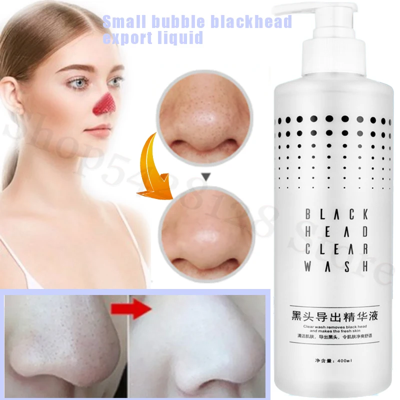 

Small Bubble Blackhead Export Liquid Beauty Salon Deep Cleansing To Remove Blackhead Acne Shrink Pores Mild and Non-irritating