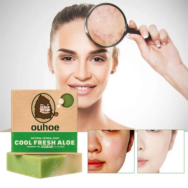 Отбеливающее мыло для осветления кожи 100 г шрамы от темных точек