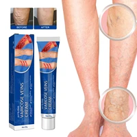 varicose vein cream massage leg pain relief dredging meridian venous relaxation angiitis phlebitis effective repair ointment 20g