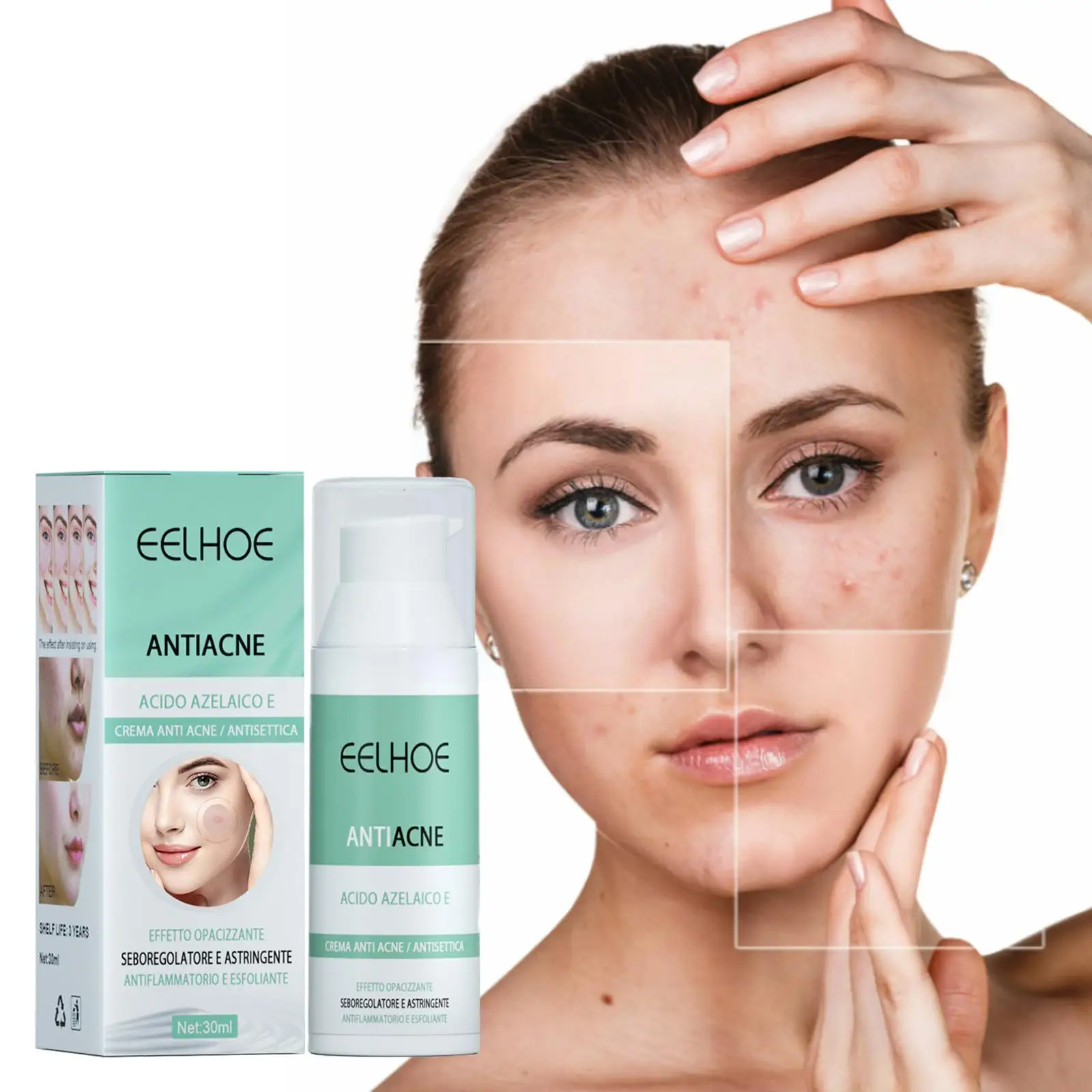 

Крем для лечения акне, растительная эссенция, Сыворотка от акне, Женский увлажняющий крем, Удаление ухода за кожей лица, сужение пор Q0a4