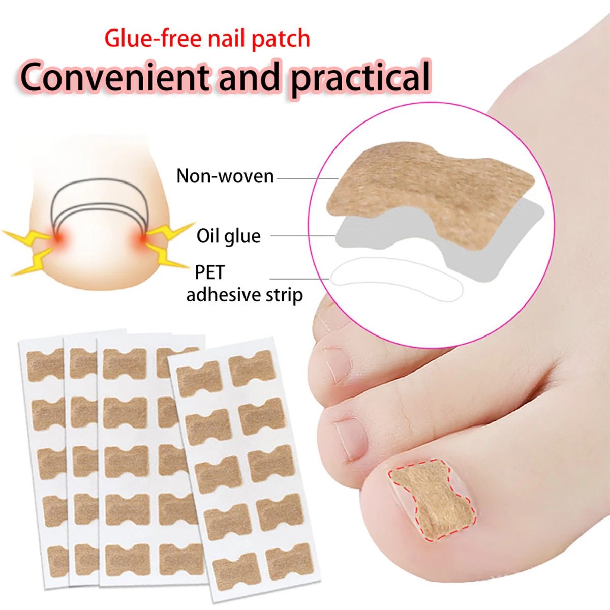 

10/20/50/100pcs Nail Correction Stickers Ingrown Toenail Corrector Patches Paronychia Treatment Recover Corrector Pedicure Tools