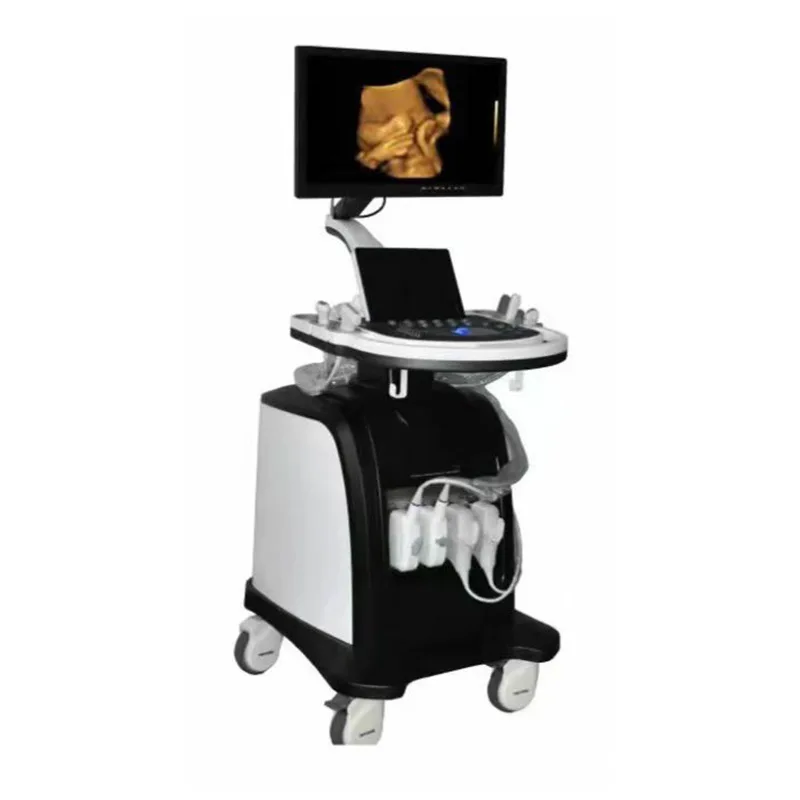

Color Doppler ultrasound diagnosis system E9 vertical all-digital high-definition all-directional observation and diagnosis