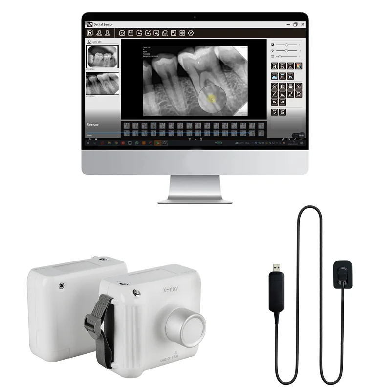 

Together Portable Teeth Xray Machine Sensor De Rayos X Dental