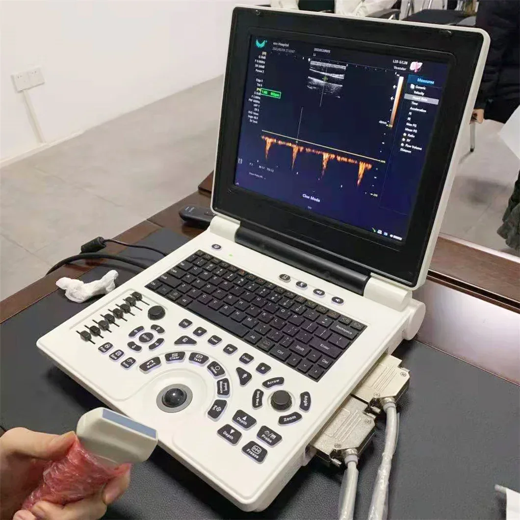 Kliniek Ziekenhuis Ob/Gyn Ноутбук Draagbare Ультразвуковая система Prijs Van машина