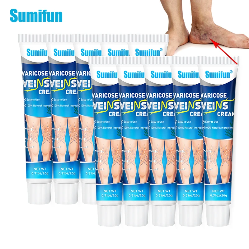 

5/10pcs Sumifun Varicose Veins Treatment Cream Relieve Vein Swelling Pain Remove Leg Varices Plaster Promote Blood Flow Ointment