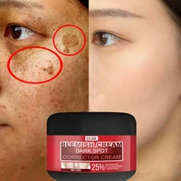 whitening freckles cream remove melasma acne spot pigment dark spots lighten melanin moisturizing brighten face skin care 50ml