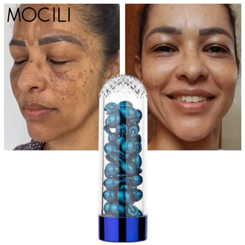 

Dark Spot Serum Capsule Whitening Effectively Removes Chloasma Pigmentation Brightening Moisturiziong Skin Care 50 Capsules