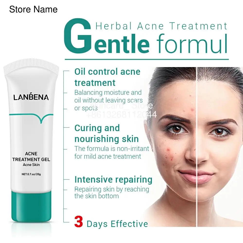 

LANBENA Acne Treatment Face Cream Blackhead Removal Damage Fade Marks Repair Acne Scars Gel Shrink Pores Whitening Skin Care 20g