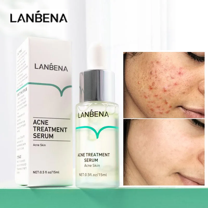 

LANBENA Salicylic Acid Acne Scar Serum Shrink Pores Oil Control Anti-Acne Repair Pimples Scars Lighten Dark Spots Whitening Skin