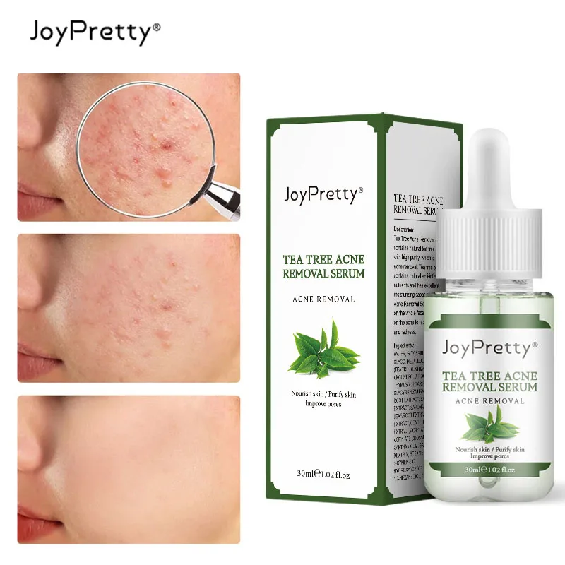

JoyPretty 30ml Herbal Hyaluronic Acid Essence Tea Tree Oil Facial Serum Treatment Acne Whitening Cosmetics Skin Care