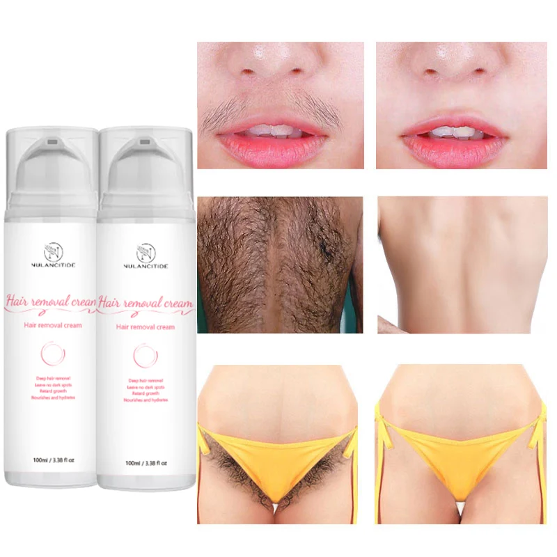 

Мазь для перманентного удаления волос, ингибитор роста волос, безболезненная для подмышек, для ног рук, средство для удаления волос, питател...