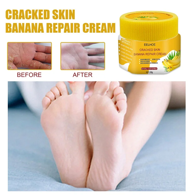

Sdotter 20g Banana Oil Foot Cream Anti-Drying Anti Cracking Repair Cream Smooth Dead Skin Removal Heel Chapped Peeling Hand Feet
