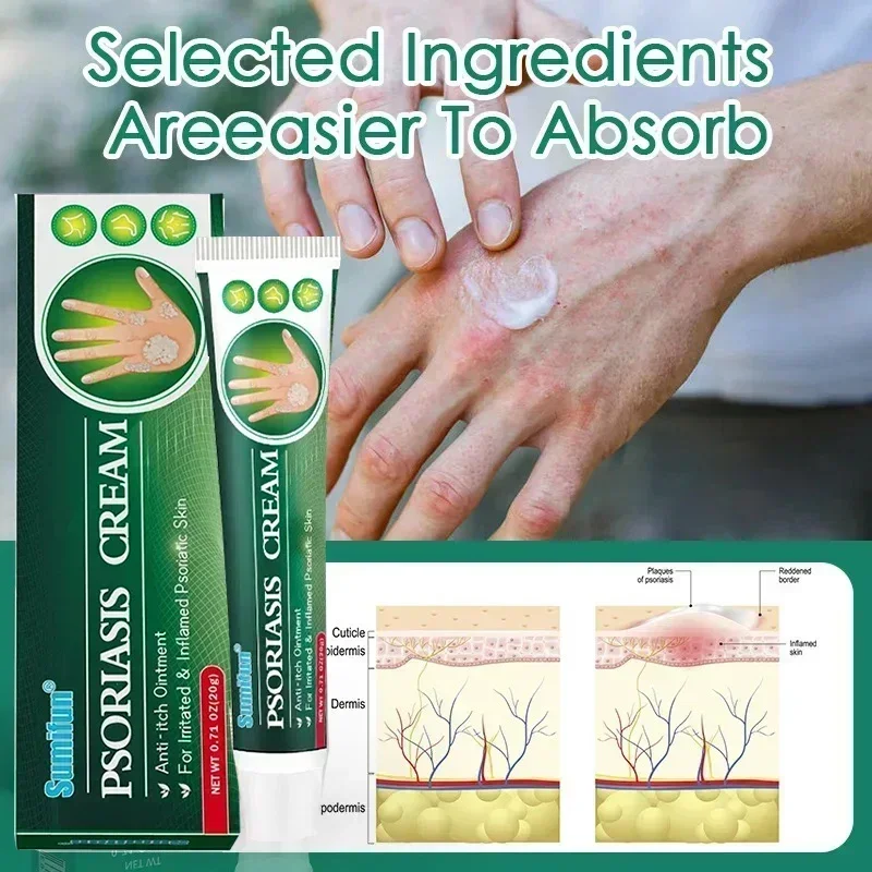 Лечение грибка при псориазе антибактериальное средство против зуда