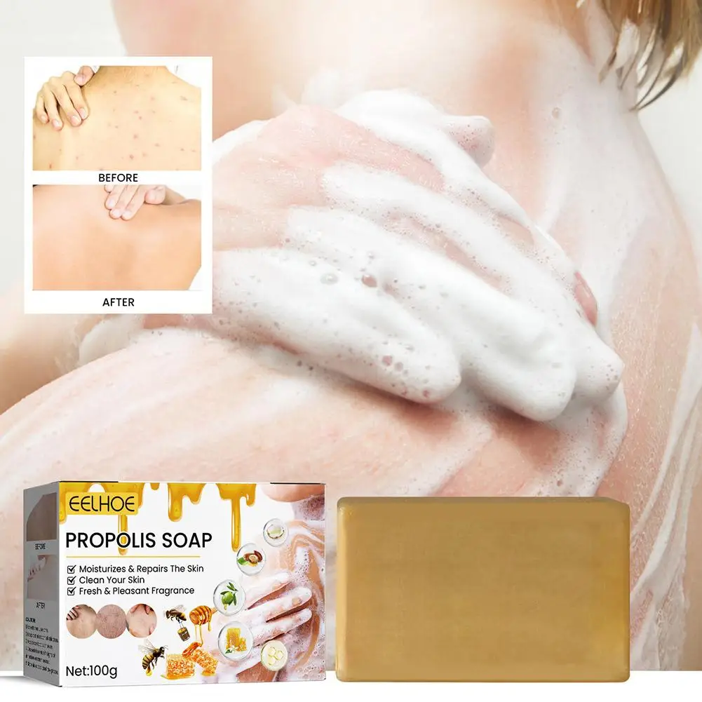 

100g Face Body Healthy Handmade Propolis Soap Deep Soap Moisturizing Wash Bath Spots Smoothing Soap Lighten Whiten Dark Cle S1H8