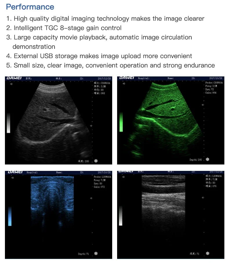 Высококачественный ультразвуковой производитель эхолографии портативный