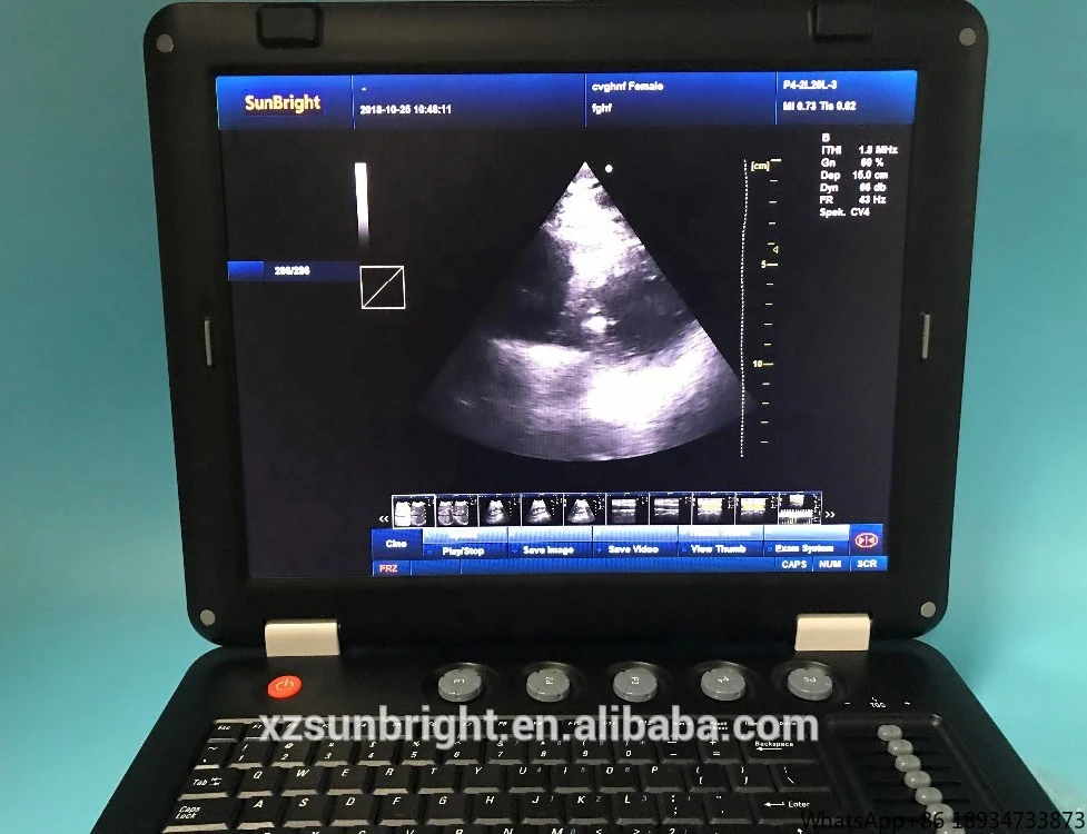 Sunbright Hospital Color Doppler Ecografo Портативный портативный ультразвуковой ультразвук для