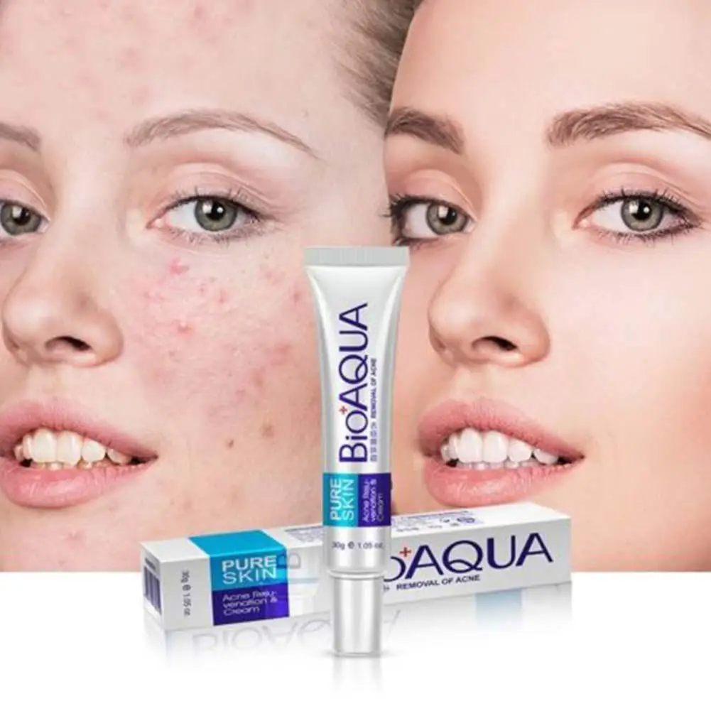 

Крем Bioaqua 30 г от акне для жирной кожи, средство для ухода за акне, удаления пор, средство для удаления шрамов, масло с усадкой H5O3