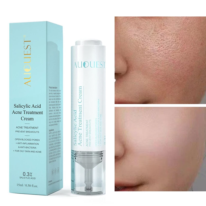 

15ml Face Repair Milk Removal Acne Blackhead Pore Shrinking Whitening Brightening Skin Salicylic Acid Moisturizing Care Serum