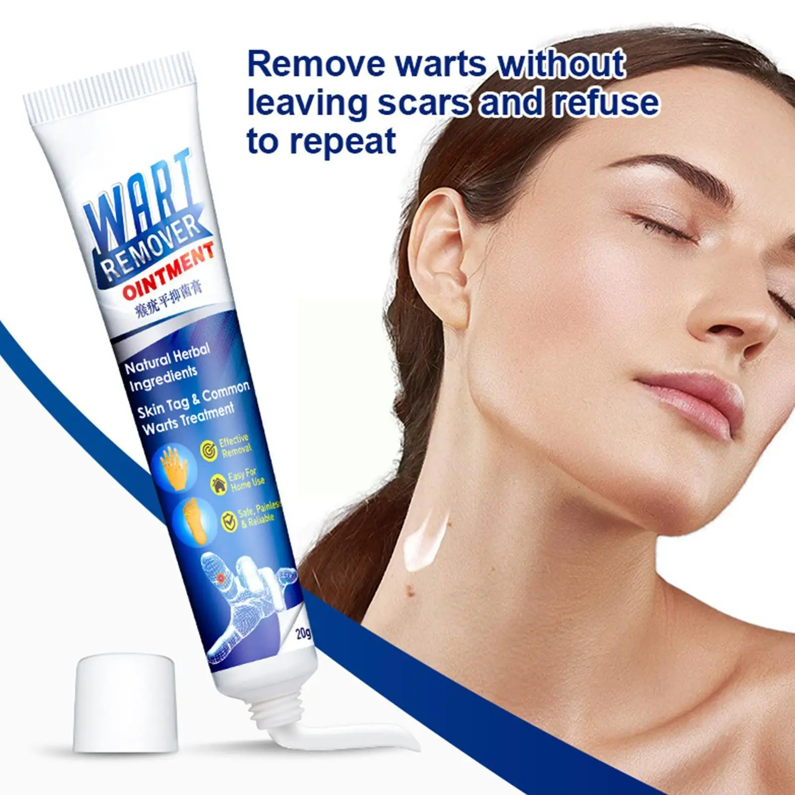 

20G Wart Removal Ointment Wart Treatment Cream Neck Flat Tag Medical Genitals Wart Armpit Wart Corns Feet Skin Wart Cream F9D6